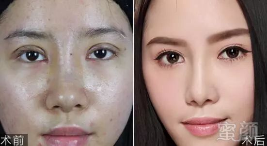 https://img.miyanlife.com/mnt/timg/171119/1342325451-9.jpg