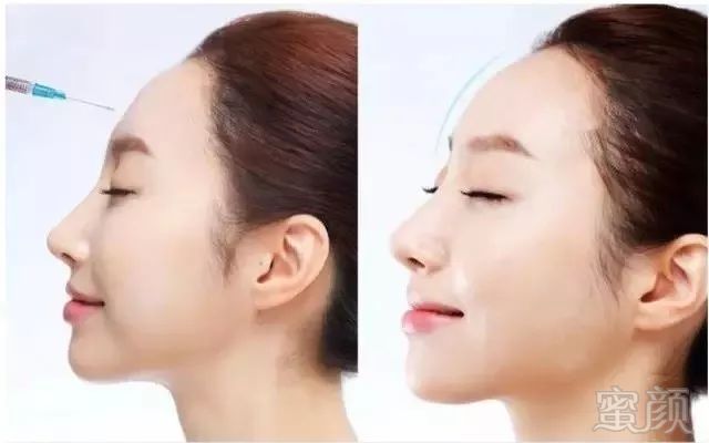 https://img.miyanlife.com/mnt/timg/171119/14194Q2J-2.jpg