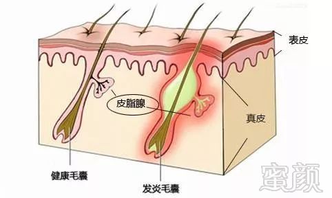 案例图片