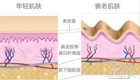 案例图片