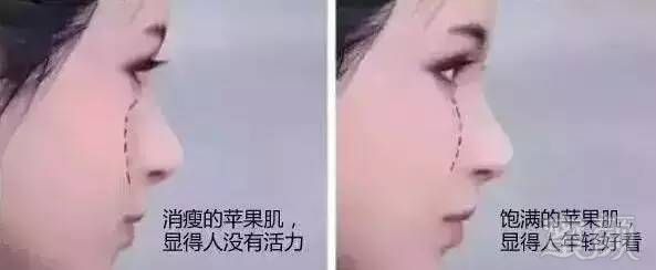 案例图片