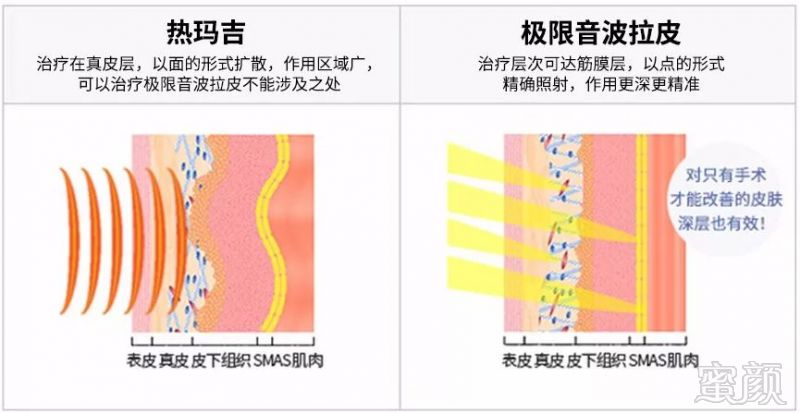 案例图片