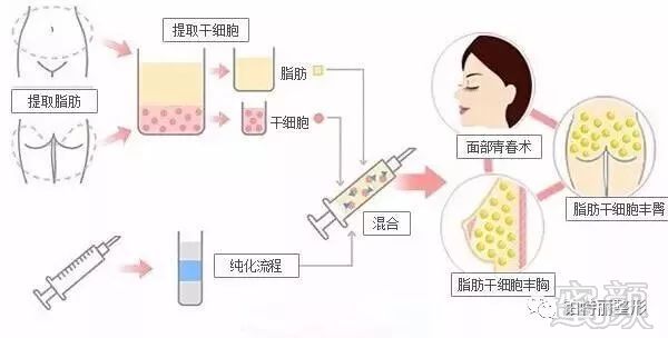 https://img.miyanlife.com/mnt/timg/171123/10050445Z-2.jpg