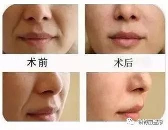 https://img.miyanlife.com/mnt/timg/171123/1005053229-7.jpg