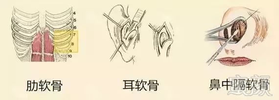 https://img.miyanlife.com/mnt/timg/171123/100FC4K-4.jpg