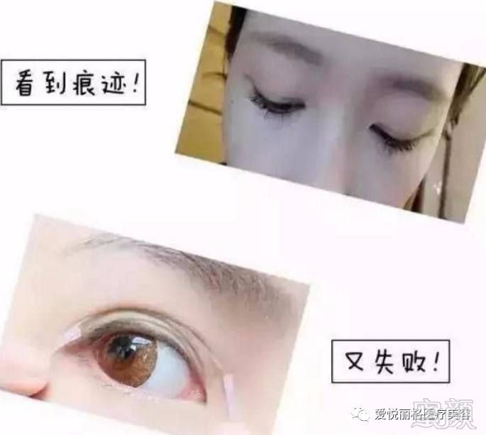 https://img.miyanlife.com/mnt/timg/171123/1036145934-0.jpg