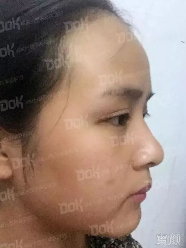https://img.miyanlife.com/mnt/timg/171123/1036425Z8-2.jpg