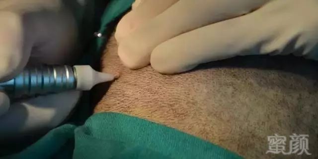 https://img.miyanlife.com/mnt/timg/171123/1045425A0-0.jpg