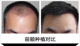 https://img.miyanlife.com/mnt/timg/171123/1045433C4-3.jpg