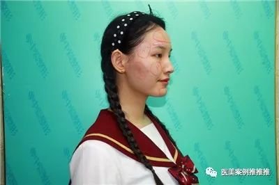 https://img.miyanlife.com/mnt/timg/171123/104S25248-1.jpg