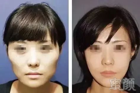 https://img.miyanlife.com/mnt/timg/171123/1105596240-16.jpg
