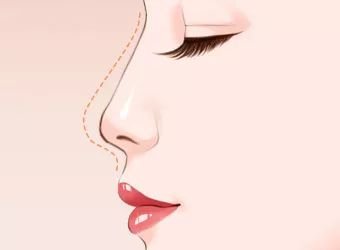 https://img.miyanlife.com/mnt/timg/171123/111130BC-2.jpg