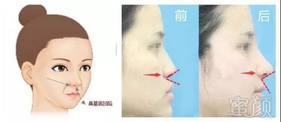 https://img.miyanlife.com/mnt/timg/171123/1111334092-14.jpg