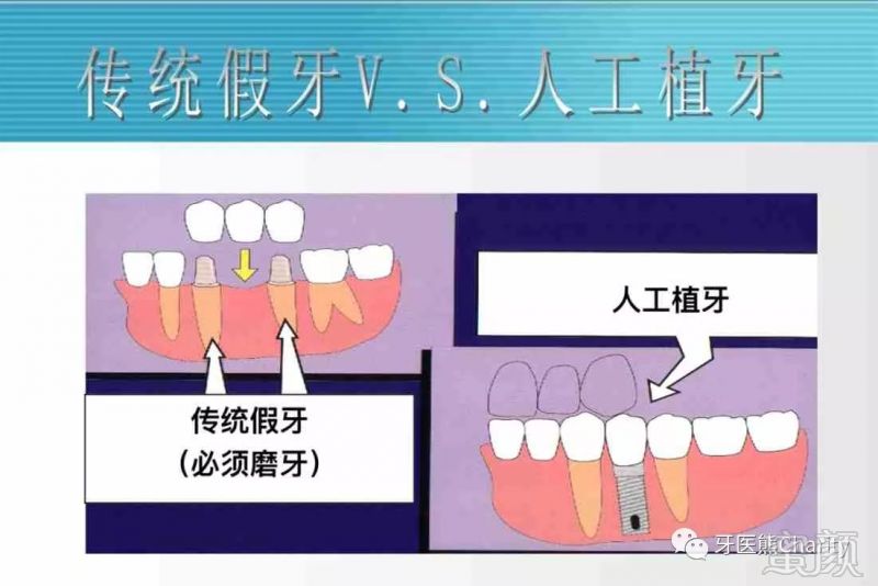 案例图片