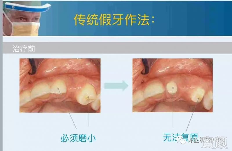 案例图片