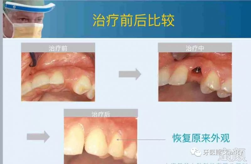 案例图片