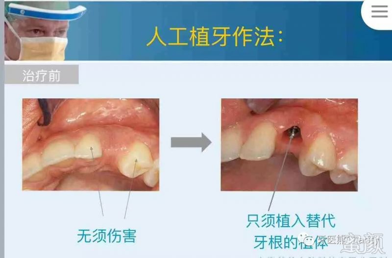 案例图片