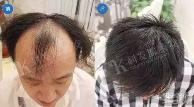 https://img.miyanlife.com/mnt/timg/171124/11025332b-2.jpg