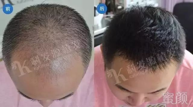 https://img.miyanlife.com/mnt/timg/171124/110253N10-1.jpg
