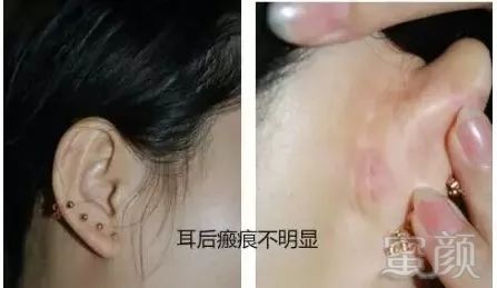 https://img.miyanlife.com/mnt/timg/171124/1259351541-10.jpg