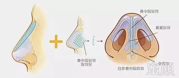 https://img.miyanlife.com/mnt/timg/171124/1259354123-8.jpg