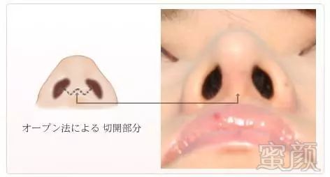 https://img.miyanlife.com/mnt/timg/171124/1259356304-11.jpg
