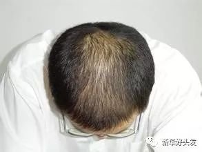 https://img.miyanlife.com/mnt/timg/171124/13210362S-0.jpg