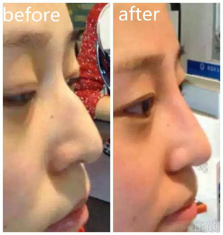 https://img.miyanlife.com/mnt/timg/171124/1323012235-10.jpg
