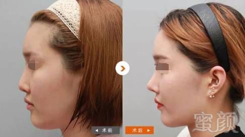 https://img.miyanlife.com/mnt/timg/171124/16012G964-5.jpg