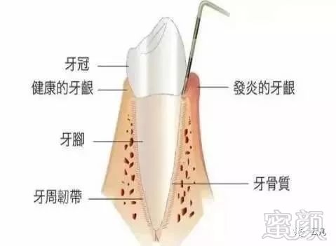 案例图片