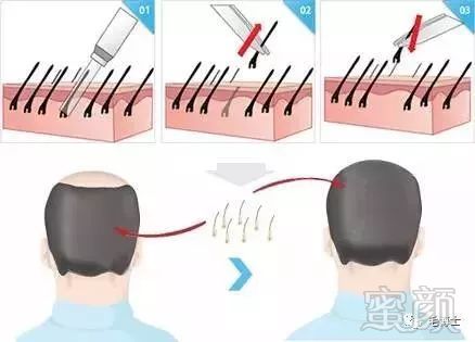 https://img.miyanlife.com/mnt/timg/171125/1024392130-4.jpg