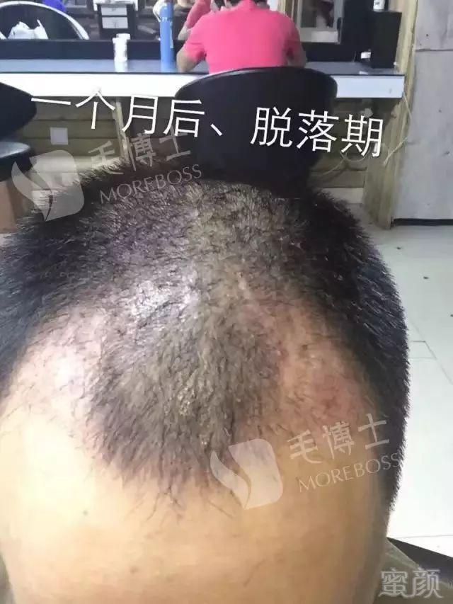 https://img.miyanlife.com/mnt/timg/171125/1024403161-9.jpg