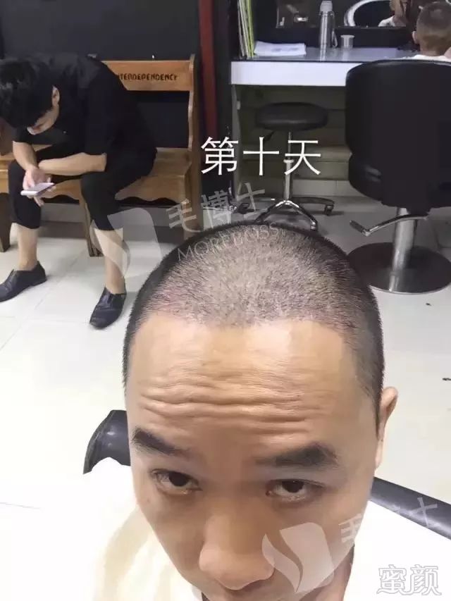 https://img.miyanlife.com/mnt/timg/171125/1024406433-8.jpg