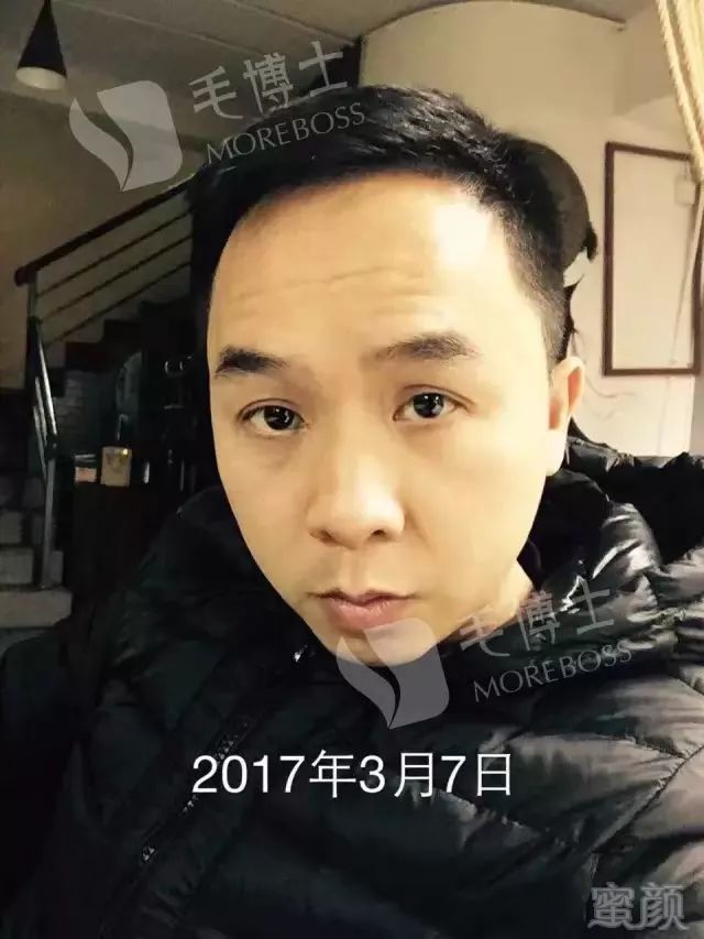 https://img.miyanlife.com/mnt/timg/171125/1024412220-11.jpg