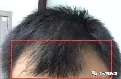 https://img.miyanlife.com/mnt/timg/171125/102R64333-1.jpg