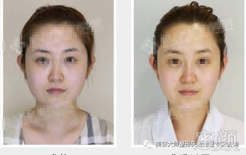 https://img.miyanlife.com/mnt/timg/171125/112I51C7-9.jpg