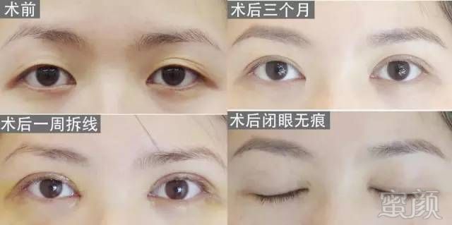 https://img.miyanlife.com/mnt/timg/171126/10311AZ9-9.jpg