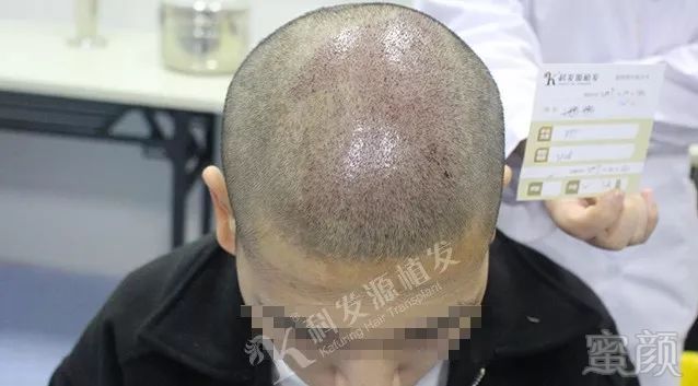 https://img.miyanlife.com/mnt/timg/171126/10555243H-10.jpg