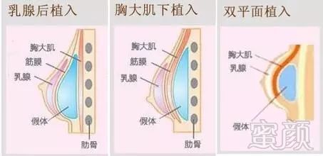 案例图片