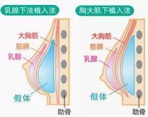 案例图片