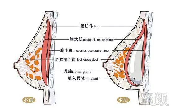 案例图片