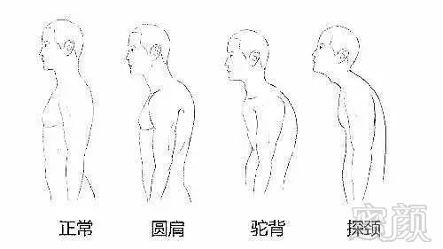 案例图片