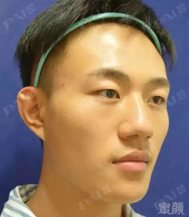 https://img.miyanlife.com/mnt/timg/171126/11334H5W-2.jpg