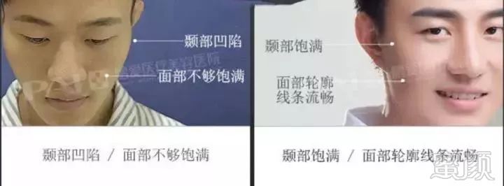 https://img.miyanlife.com/mnt/timg/171126/11334V348-5.jpg