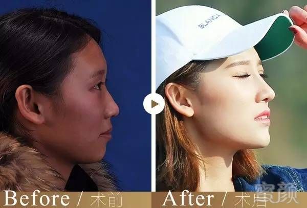 https://img.miyanlife.com/mnt/timg/171127/103253O14-5.jpg
