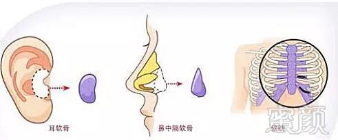 https://img.miyanlife.com/mnt/timg/171127/113511CN-2.jpg