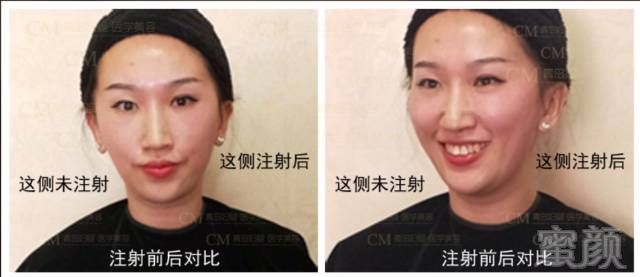 https://img.miyanlife.com/mnt/timg/171128/12340C112-9.jpg