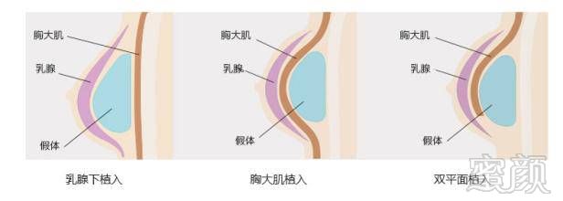 案例图片