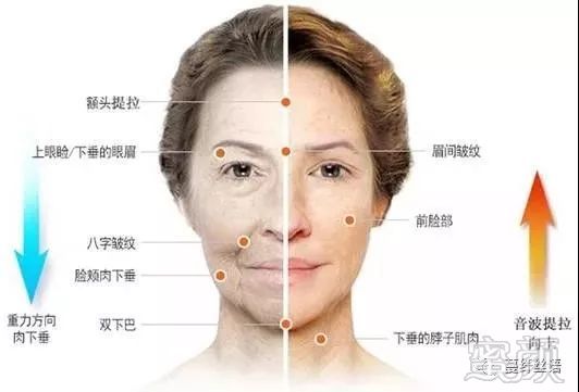 https://img.miyanlife.com/mnt/timg/171128/133123H39-4.jpg