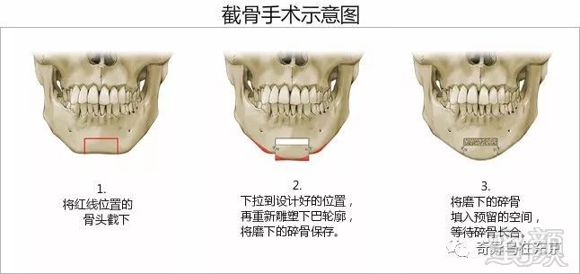 案例图片